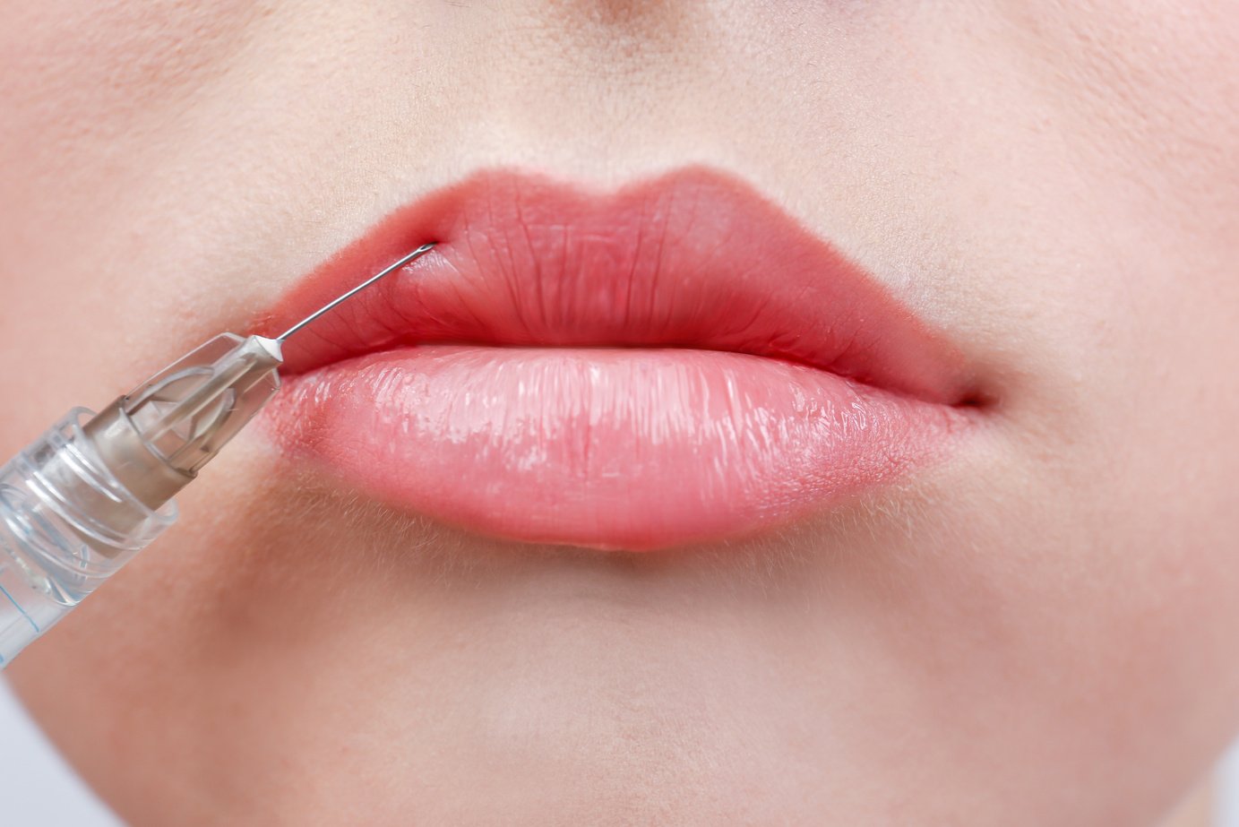 Young Woman Receiving Filler Injection in Lips